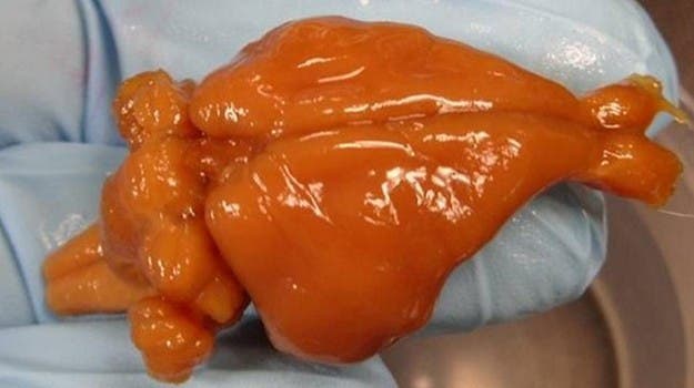 The rabbit brain after being thawed. Image:  21st Century Medicine 