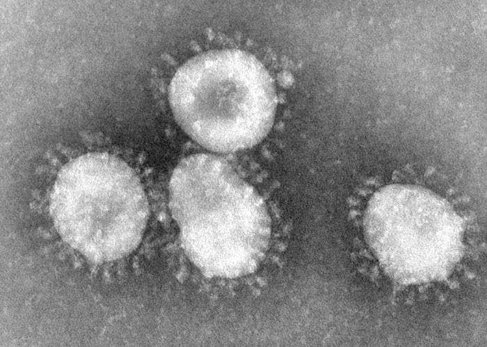 The newly identified virus, known as WIV1-CoV, could bind to the same receptors as SARS-CoV. 
Image credits CDC/Dr. Fred Murphy