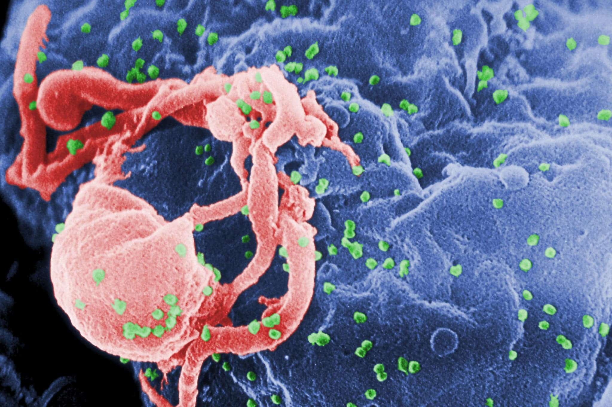 Scanning electron micrograph of HIV-1, colored green, budding from a cultured lymphocyte.  Photo Credit: C. Goldsmith Content Providers: CDC
