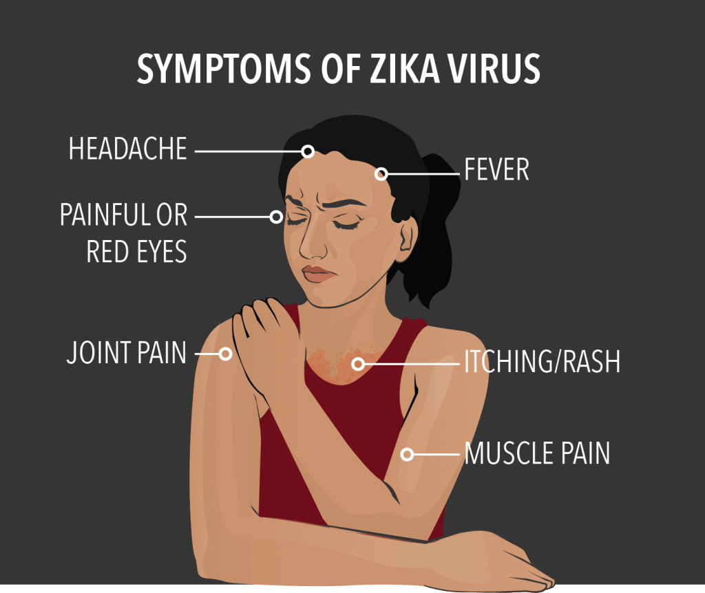 zika symptoms 