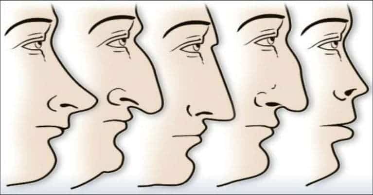 Nose shapes