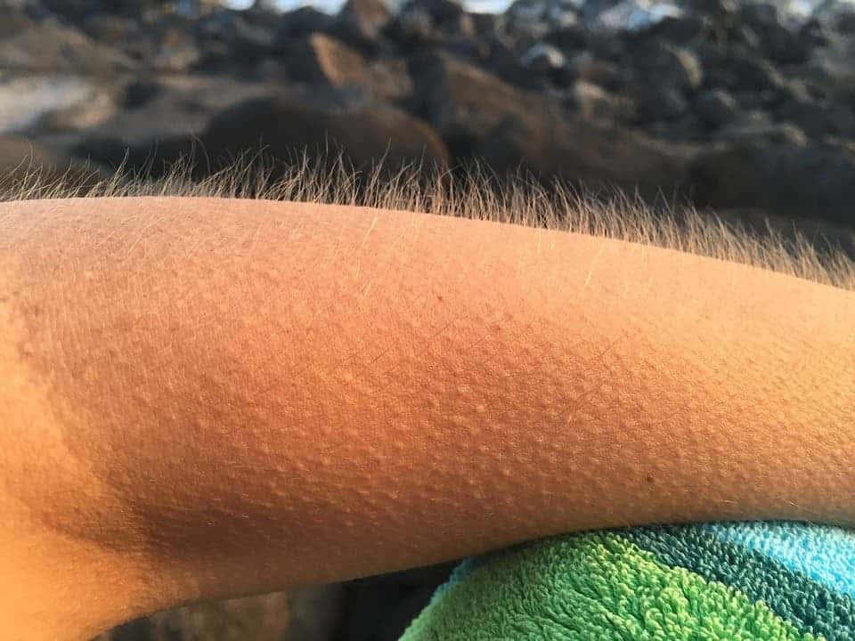 In humans, goosebumps are strongest on the arms.