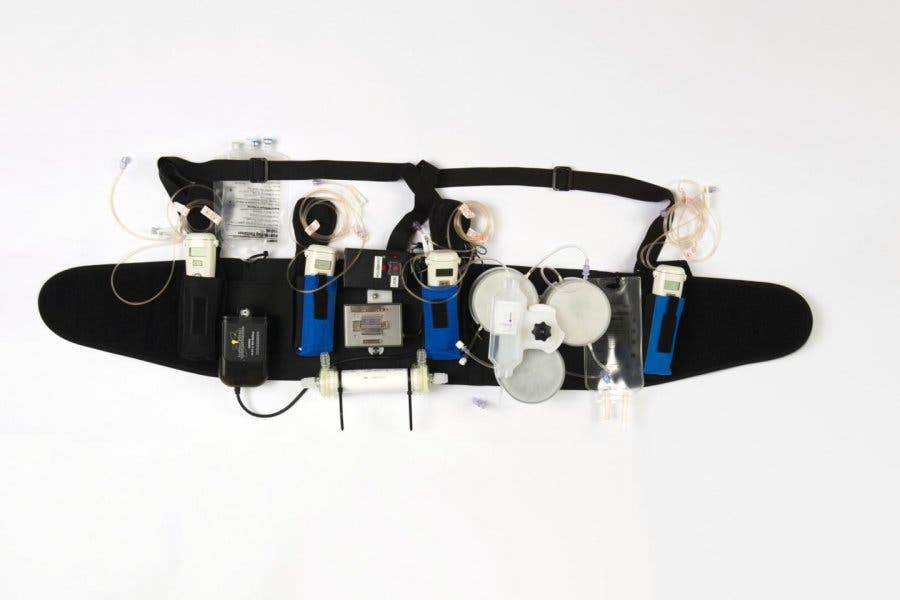 The working prototype of the Wearable Artificial Kidney developed by Dr. Victor Gura and his team. 
Image credit: Stephen Brashear/University of Washington.