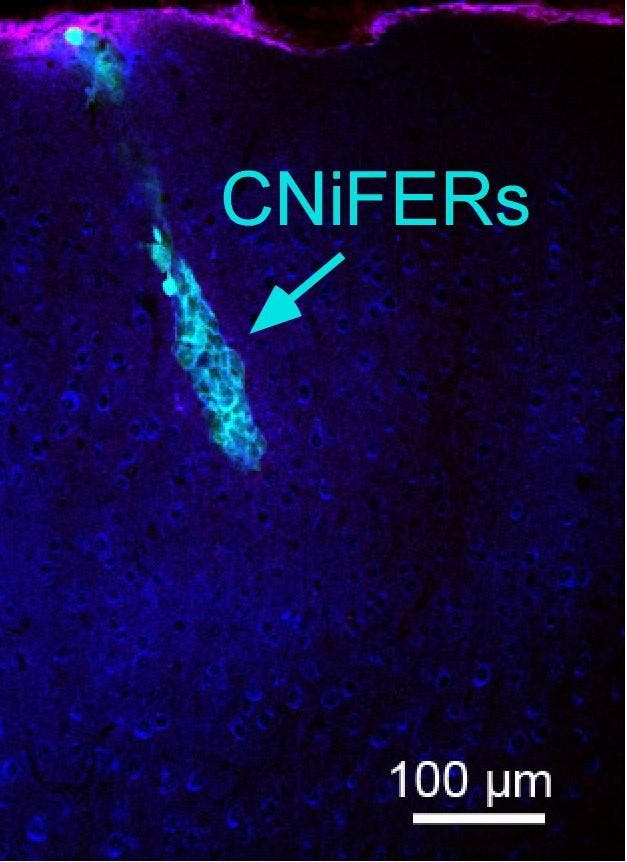 In a mouse brain, cell-based detectors called CNiFERs change their fluorescence when neurons release dopamine. Photo credits: Slesinger & Kleinfeld labs