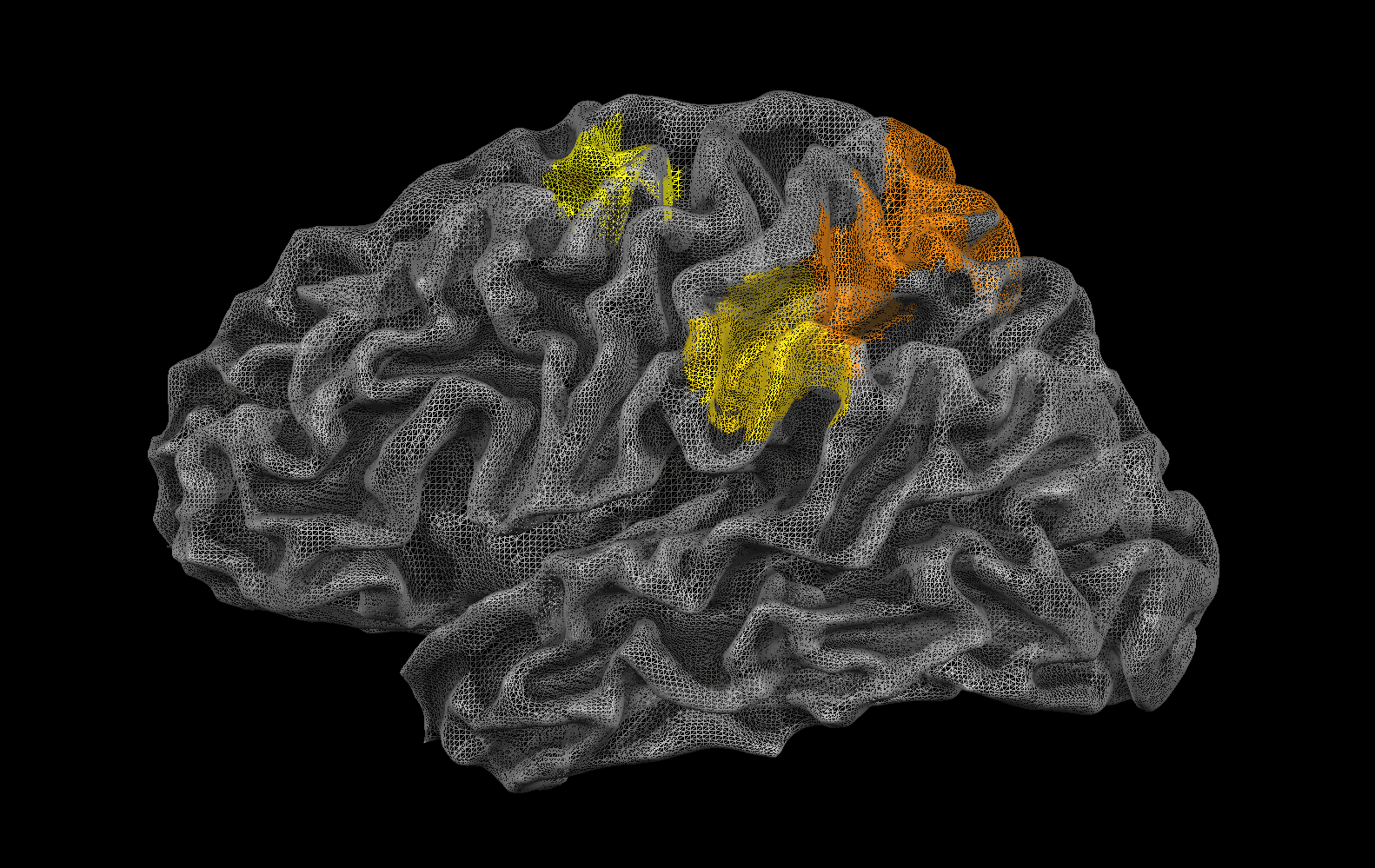 Here it is! The location of the 'physics engine' in the brain is highlighted in color in this illustration. Jason Fischer/JHU
