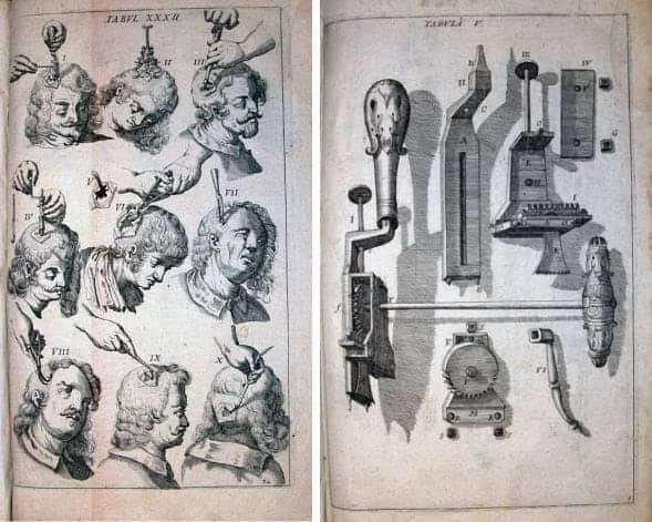 Two prints from Armamentarium chirurgicum, by Johannes Scultetus (1655), showing how trepanation was performed (left) and a set of trepanation instruments (right).
