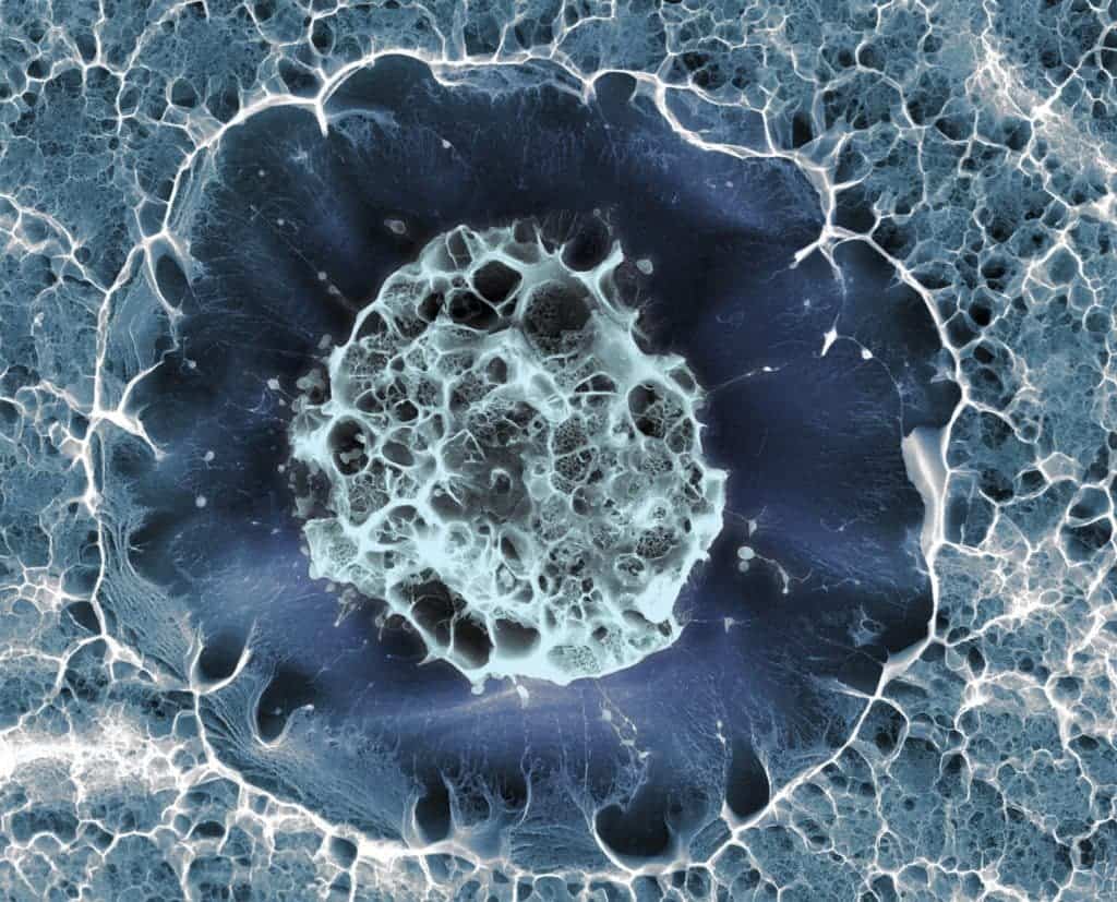 Cryogenic scanning electron micrograph of a single human stem cell. Image credits Sílvia A Ferreira, Cristina Lopo, Eileen Gentleman / King’s College London.