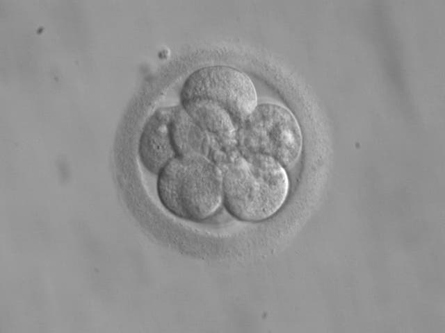 An eight-cell embryo. Credit: Wikimedia Commons