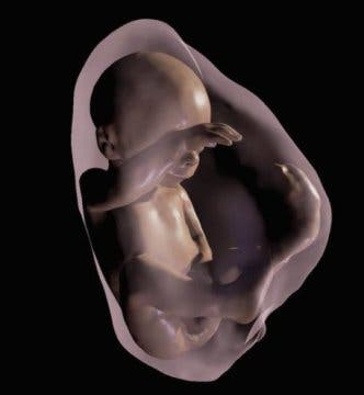 3D virtual model MRI view of fetus at 26 weeks.
Credit: Image courtesy of Radiological Society of North America