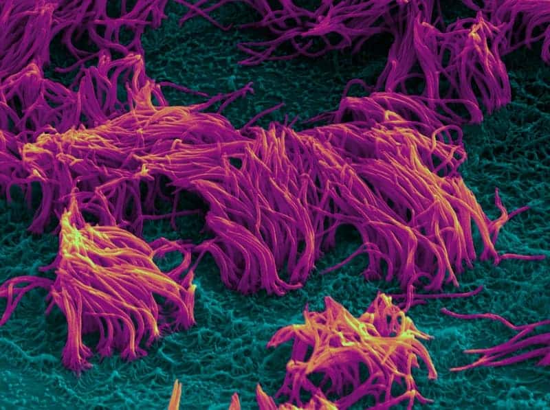 Lung cilia (purple) protruding from the lung epithelium. The image was taken with a scanning electron microscope. Credit: Wyss Institute/Harvard University