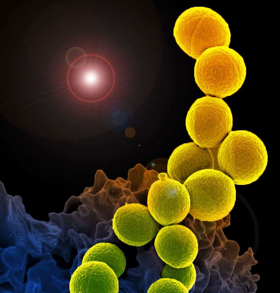 Methicillin-Resistant Staphylococcus aureus (MRSA) 
Colorized scanning electron micrograph of a white blood cell interacting with an antibiotic resistant strain of Staphylococcus aureus bacteria. Credits: NIAID