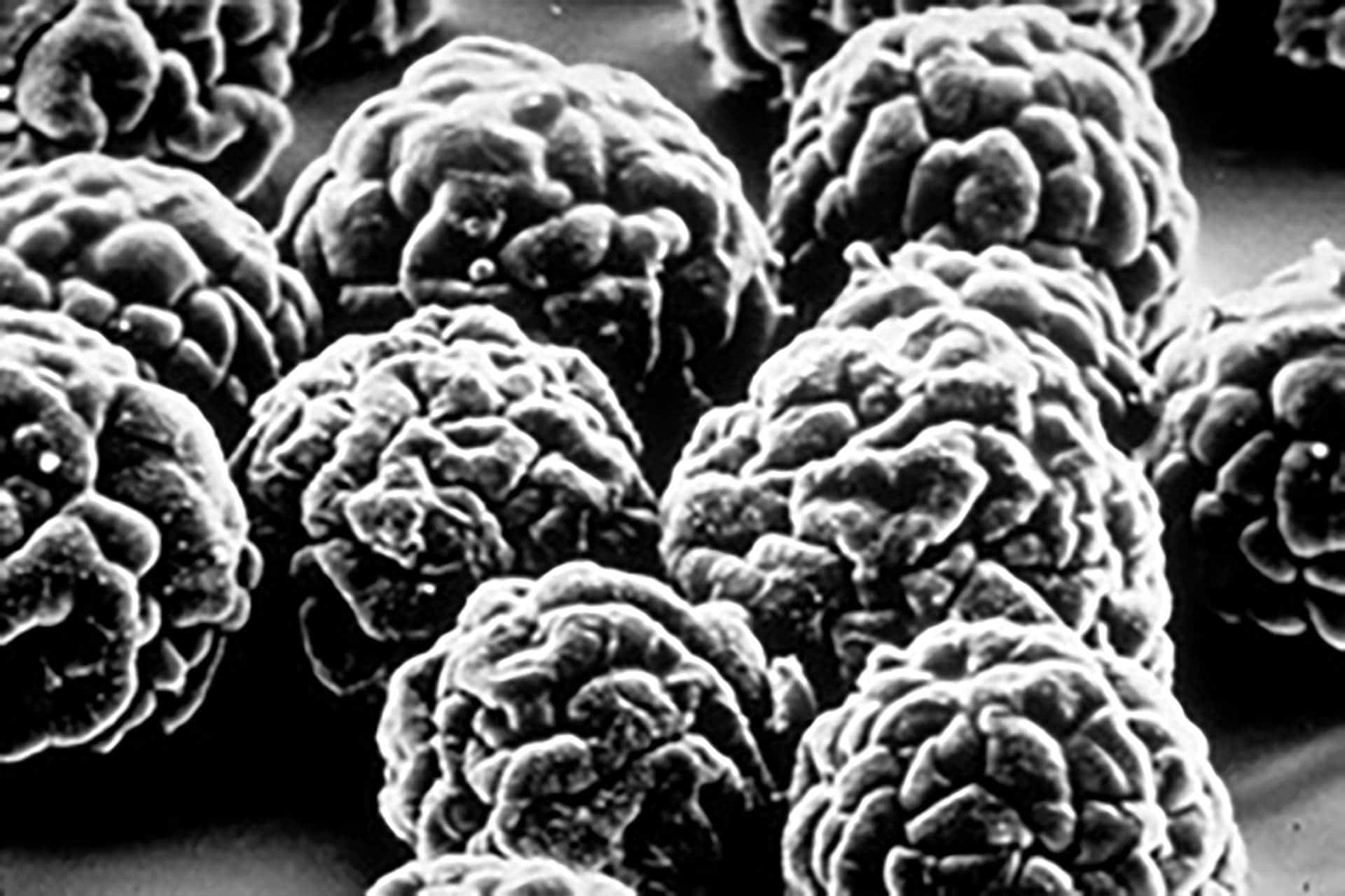 The wild poliovirus as seen through a scan electron microscope. The virus invades the nervous system, causing paralysis in one out of every 200 children. Credit: Polio Eradication.