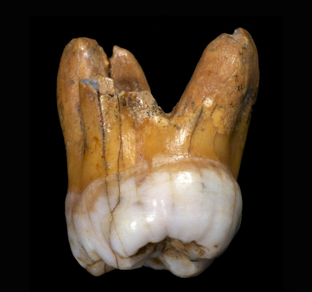 A molar that belonged to an ancient Denisovan. Credit: Max Planck Institute for Evolutionary Anthropology.