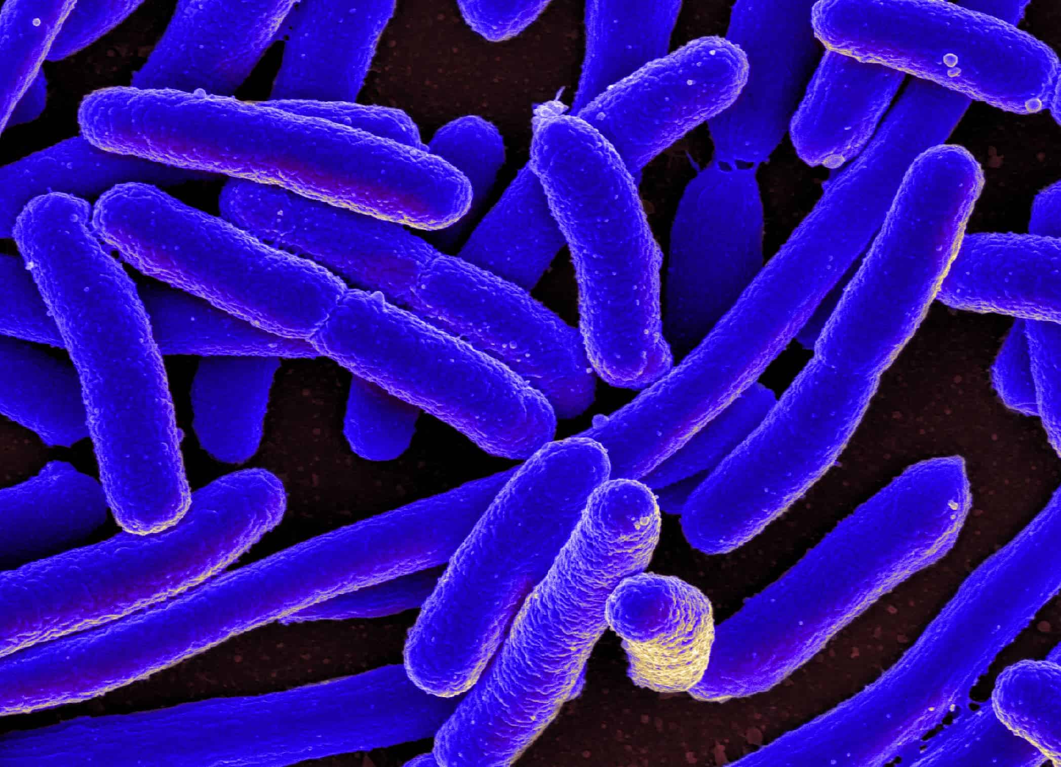 Bacteria can be used to make power. Image credits: NIAID.