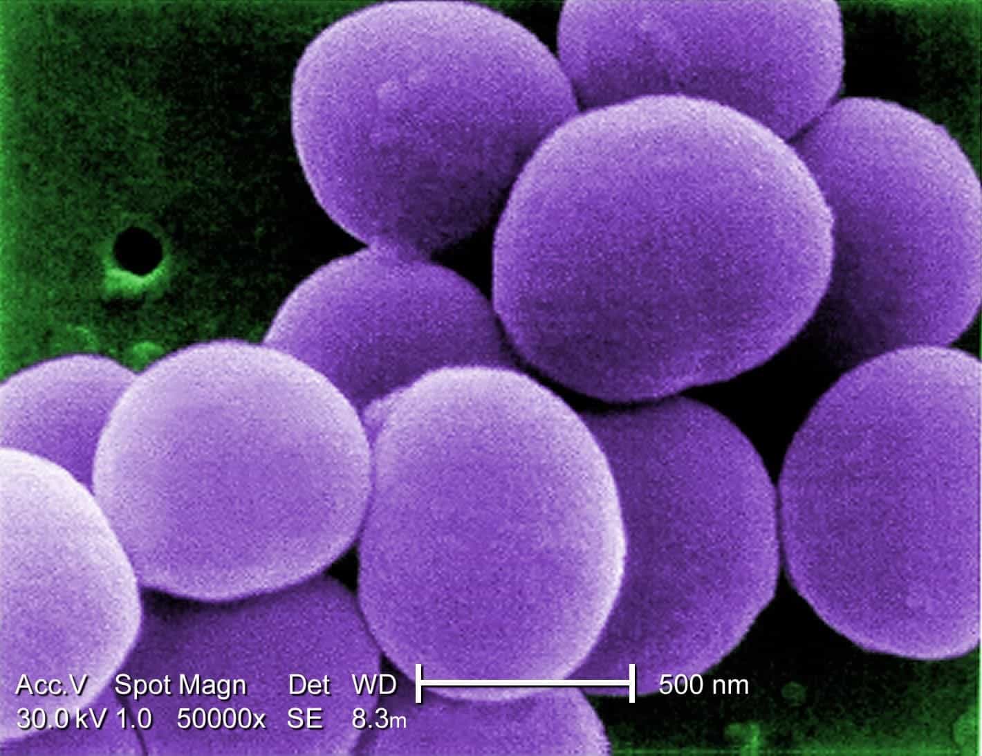 Staphylococcus aureus, one of the main drug-resistant culprits. Image credits: CDC/ Matthew J. Arduino, DRPH.