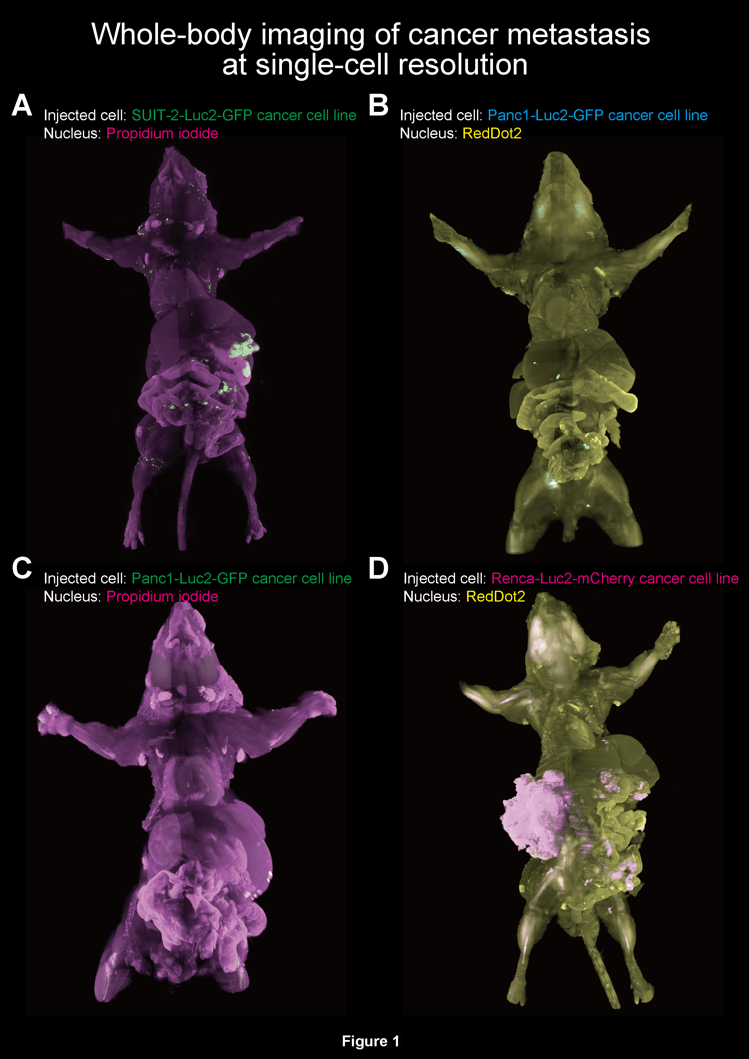 Whole-body imaging of cancer metastasis at single-cell resolution. Credit: Prof. Hiroki R. Ueda (UTokyo/RIKEN)/Prof. Kohei Miyazono (UTokyo).
