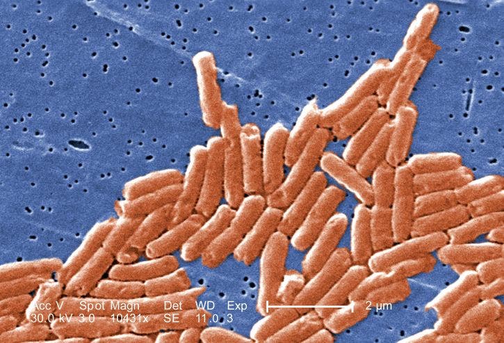 Salmonella bacteria is one common food-borne illness. Image credits: Pixnio.