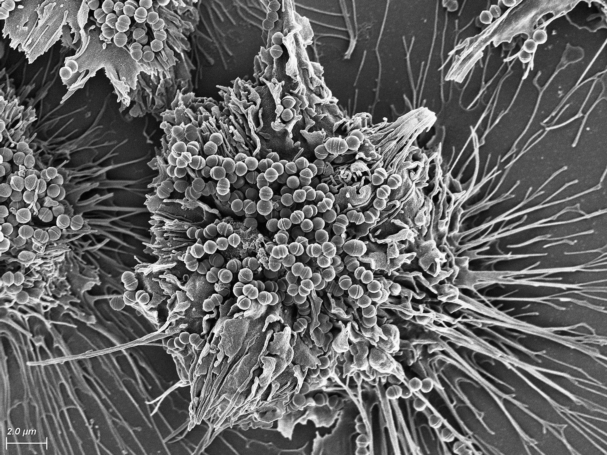 Обида микроскоп. Микробы бактерии вирусы под микроскопом. Микрофотографии бактерий. Сканирующая микрофотография клетка. Микрофотографии вирусов.