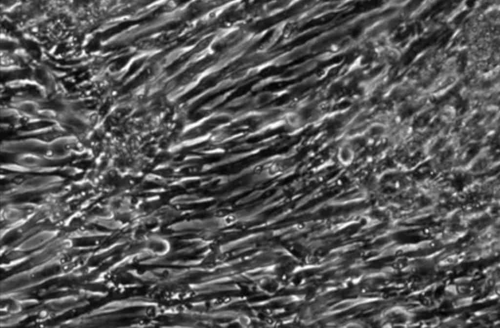 Researchers have grown the first functioning human muscle tissue from skin cells reprogrammed into stem cells. Credit: Duke University. 