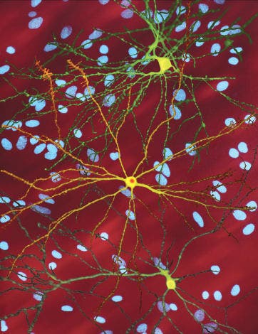 Several neurons colored yellow and having a large central core with up to two dozen tendrils branching out of them, the core of the neuron in the foreground contains an orange blob about a quarter of its diameter, found in HD 
Source: Wikipedia