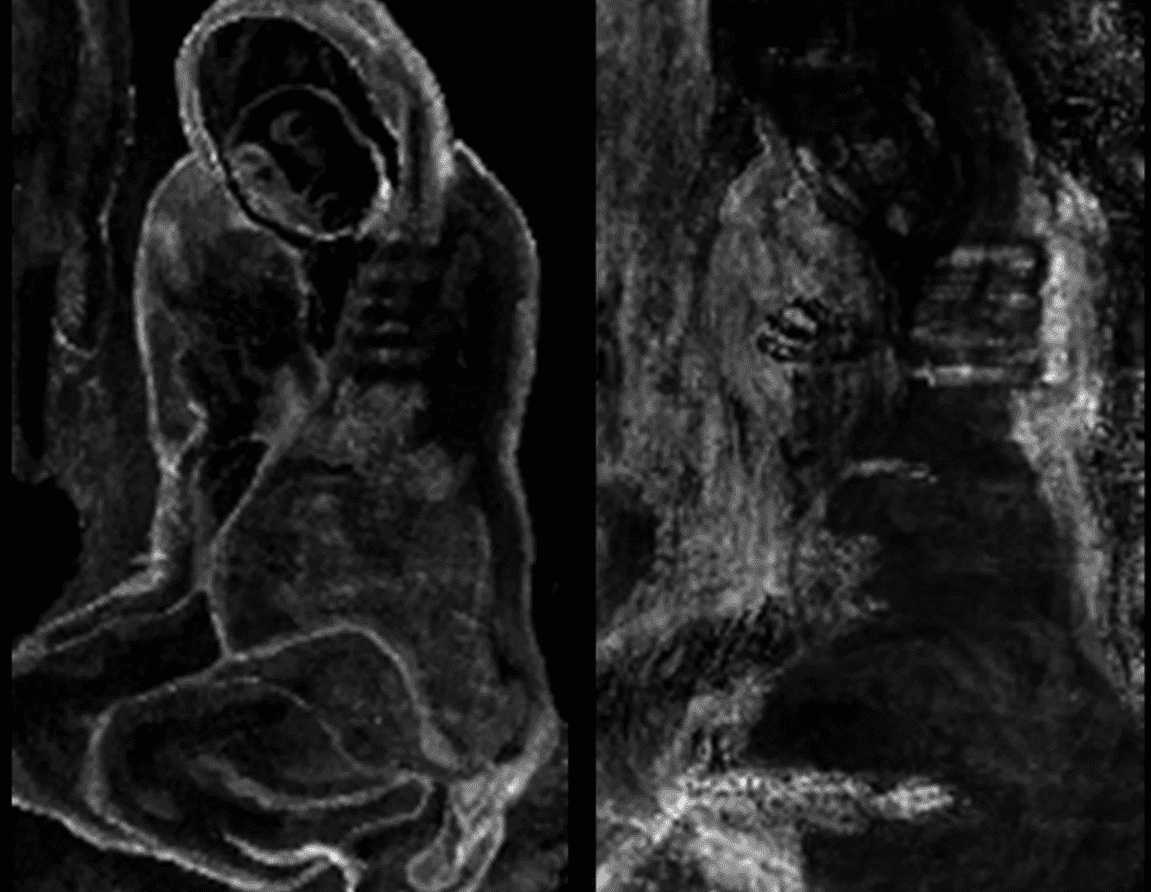 X-ray fluorescence revealed hidden layers of artwork in Picasso's 
