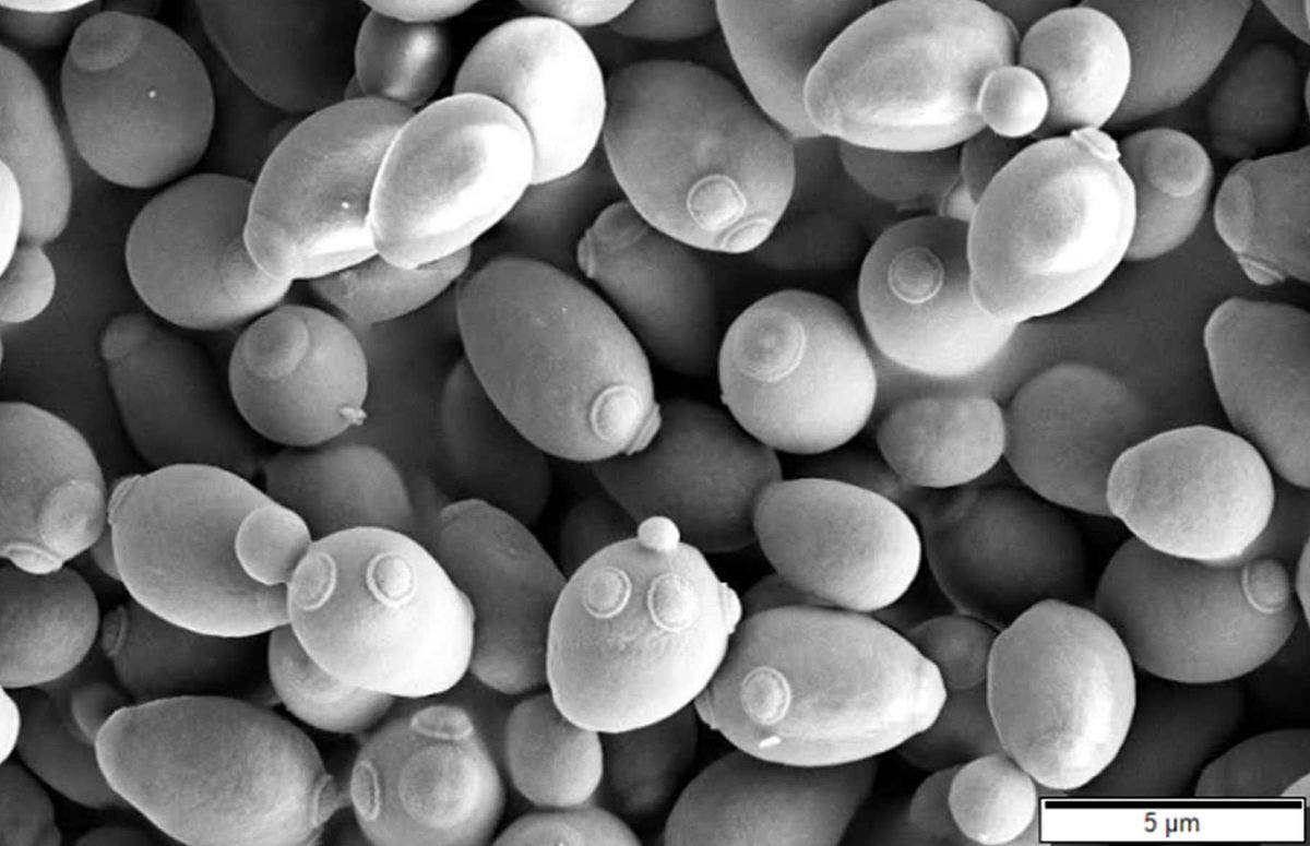 Saccharomyces cerevisiae, as viewed under a scanning electron microscope. Image credits: Mogana Das Murtey and Patchamuthu Ramasamy.