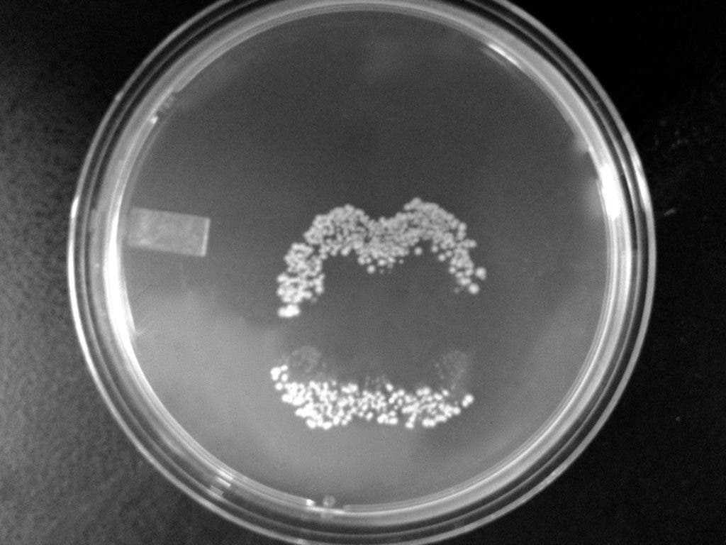 Bacteria lip print.