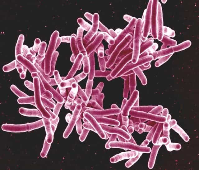 Scanning electron micrograph of Mycobacterium tuberculosis bacteria, which cause TB. Credit: NIAID, Flickr.