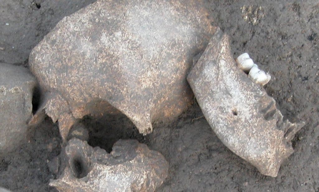 Conifer resins identified on Iron Age skulls indicate that a gruesome ancient Celtic practice may be real. Credit: Fouille Programmée Le Cailar.