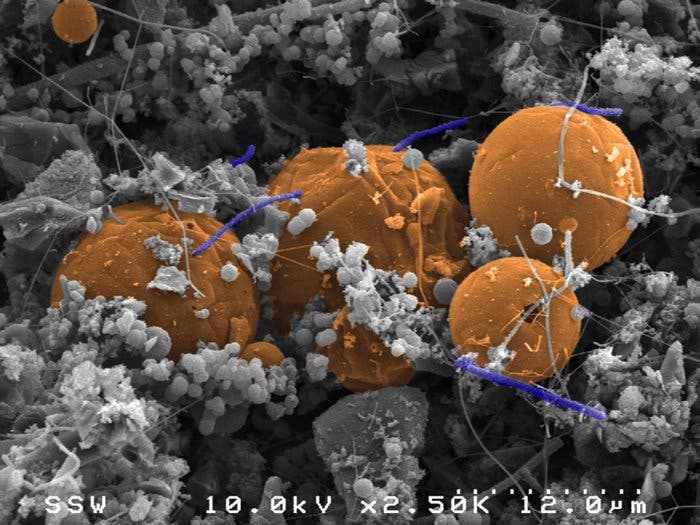 Candidatus Desulforudis audaxviator (the orange carbon spheres are carbon that the bacteria eats) collected from under Mponeng gold mine in South Africa. Credit: University of Queensland.
