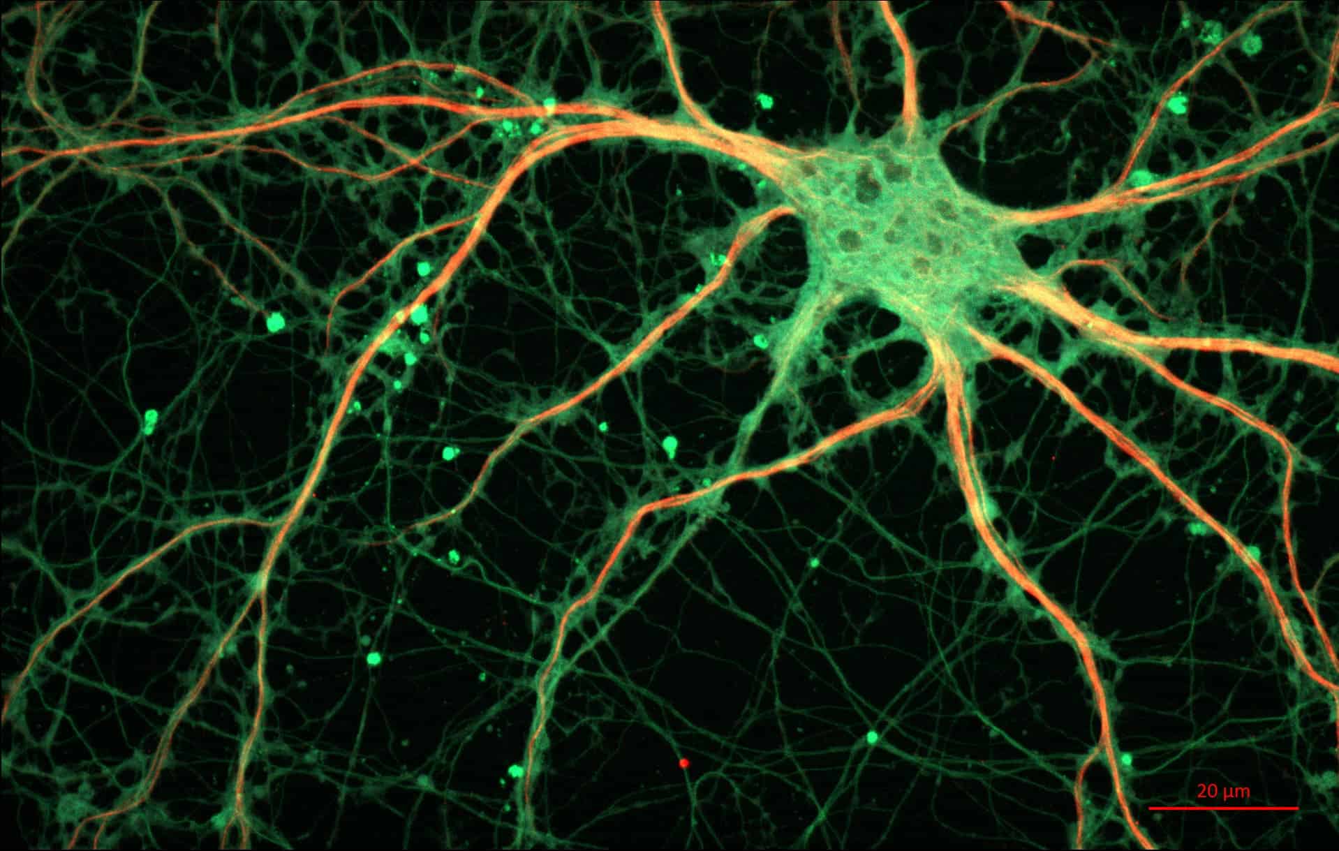 Cultured Rat Hippocampal Neuron. Image credits: ZEISS.