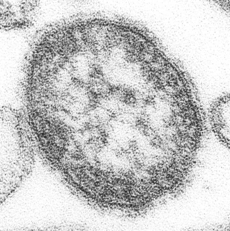 A transmission electron micrograph (TEM) of a single virus particle, or “virion”, of measles virus. Image credits: Cynthia S. Goldsmith / CDC.