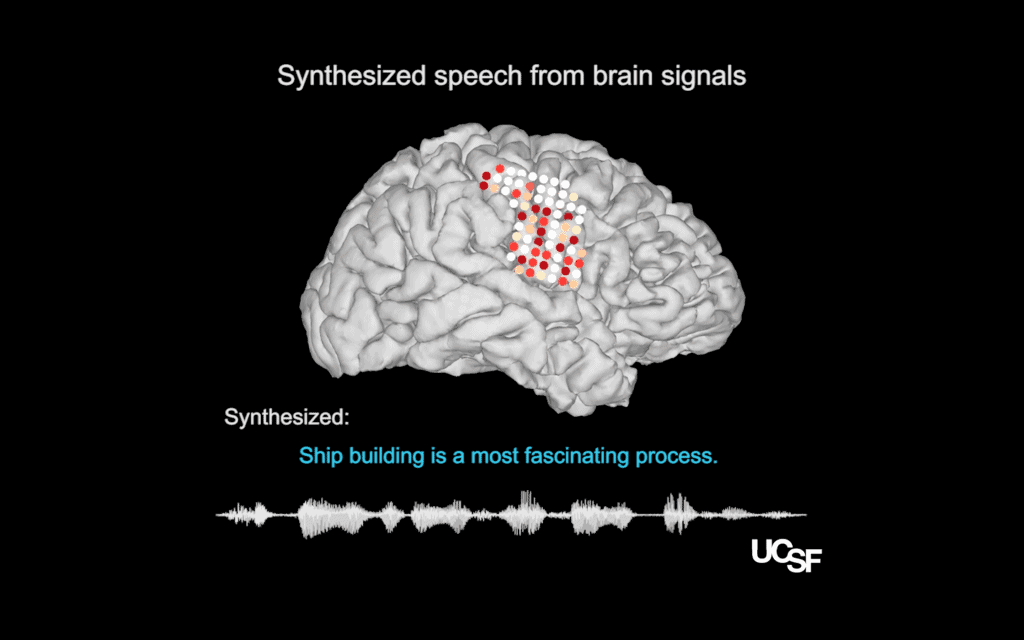 Illustrations of electrode placements on the research participants’ neural speech centers, from which activity patterns recorded during speech (colored dots) were translated into a computer simulation of the participant’s vocal tract (model, right) which then could be synthesized to reconstruct the sentence that had been spoken (sound wave & sentence, below). Credit: Chang lab / UCSF Dept. of Neurosurgery.