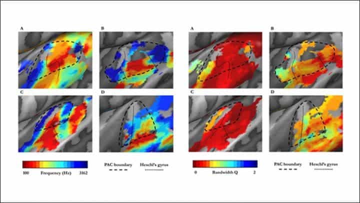 Tonotopic maps in auditory cortex for four example subjects. Credit: Huber et al., JNeurosci (2019).