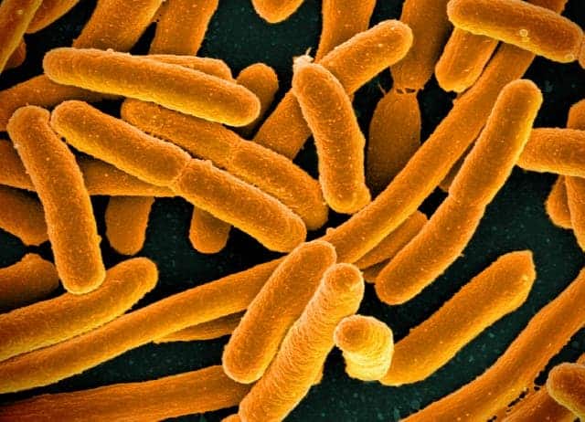 E. coli. Image credits: NIAID.