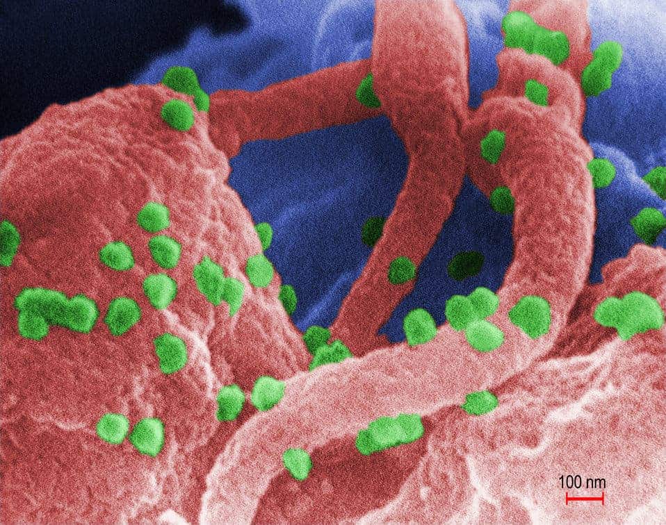 Scanning electron microscope image of a human immunodeficiency virus (HIV-1). Credit: Public Domain.