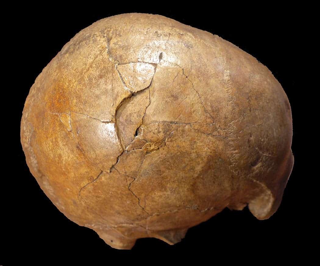 The Cioclovina skull has two large fractures on it, likely from interpersonal violence during the Upper Paleolithic.
Credit: Kranioti, EF. et al. PLOS ONE. 2019.