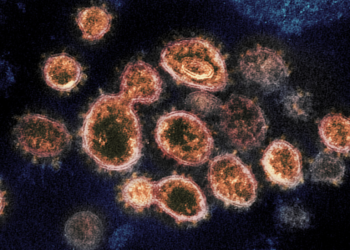 SARS-CoV-2, the virus that causes COVID-19, isolated from a patient in the U.S. Image credits: NIAID-RML.