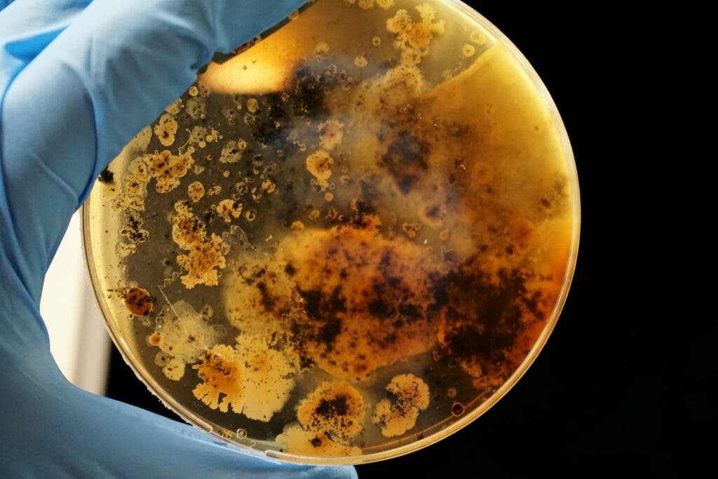 Petri Dish Bacteria