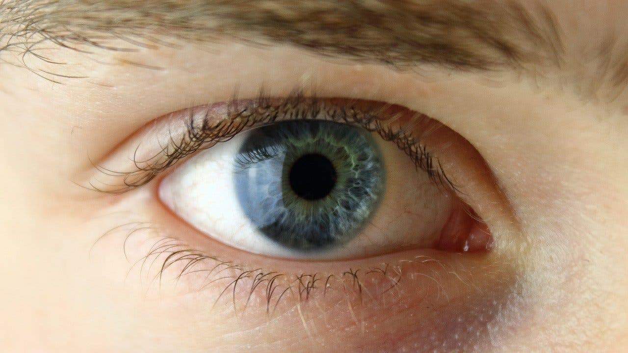human eye mutations