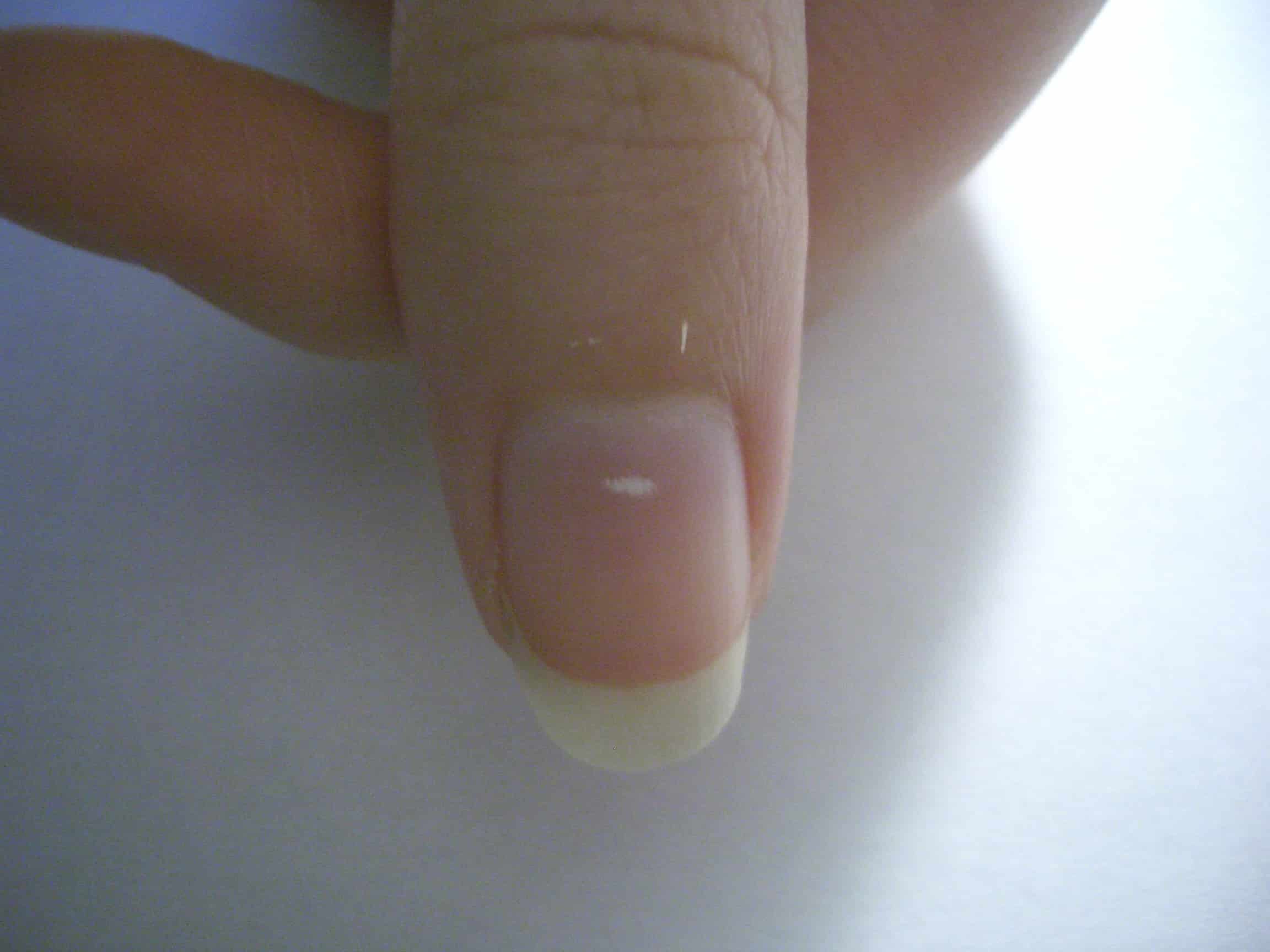 The Truth Behind the White Spots on Nails