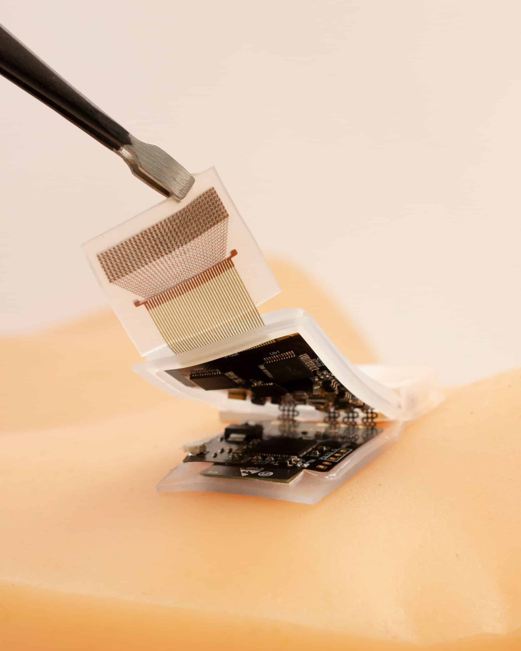 A wearable ultrasonic-system-on-patch for deep tissue monitoring.  