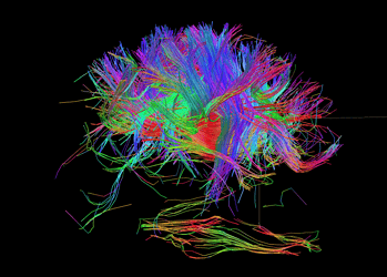 White matter fiber architecture of the brain. Image credit: University of Southern California.