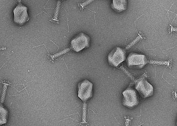 Electron micrograph of phages. Image credits: Matthew Dunne / ScopeM / ETH Zurich.