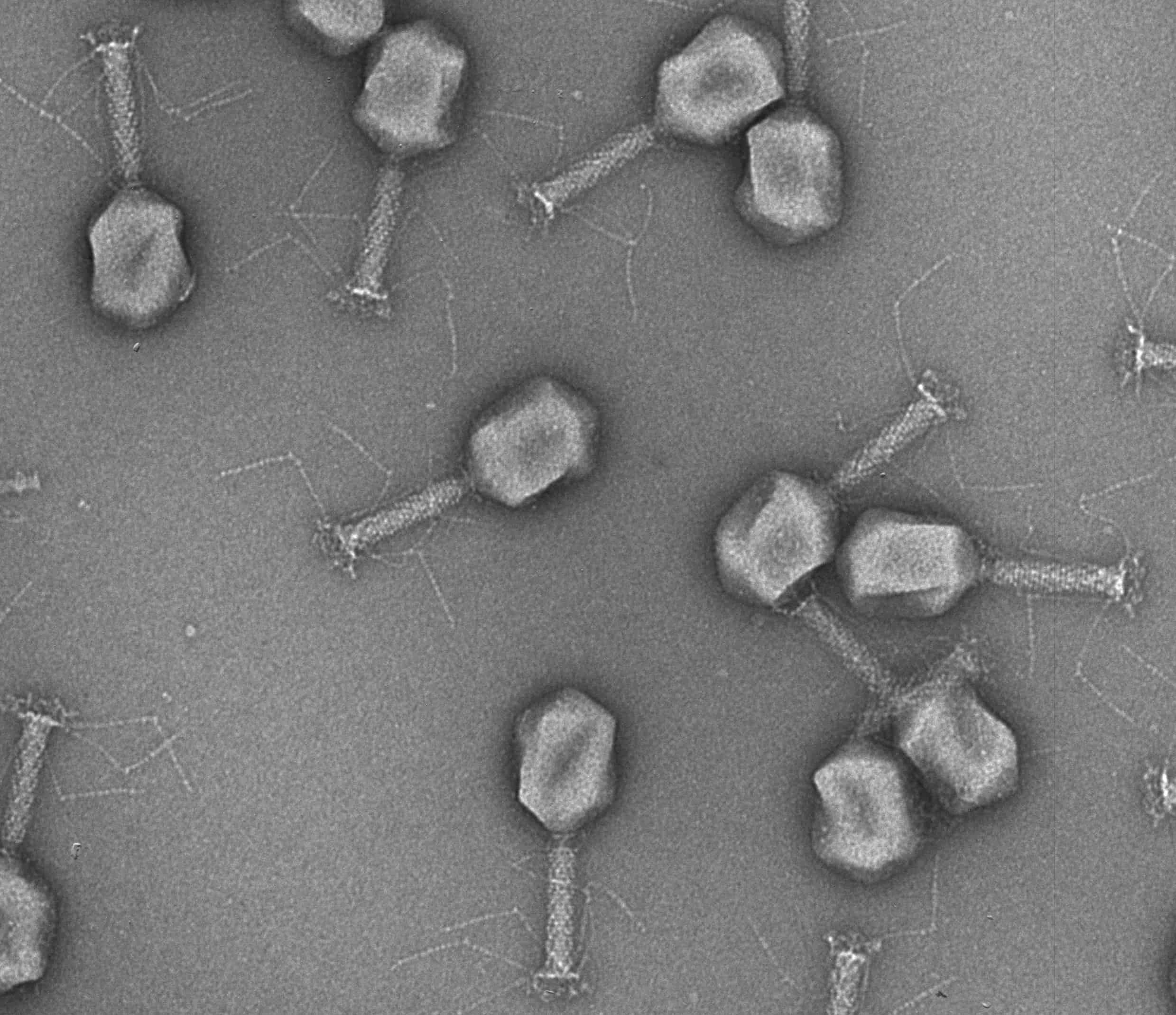 virus electron micrograph