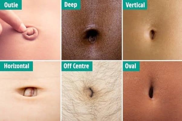Belly button types