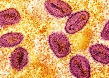Mpox virus. Image credits: Flickr / NIAID.