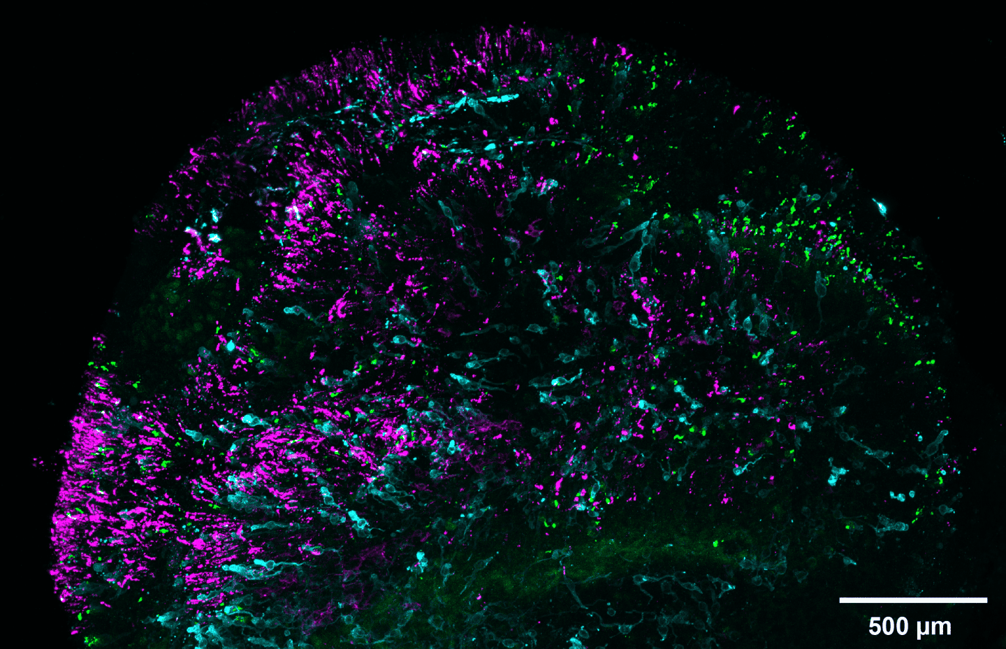 Retinal organoid marked to show blue cones in cyan and green/red cones in green. Cells called rods that help the eye see in low-light or dark conditions are marked in magenta.

