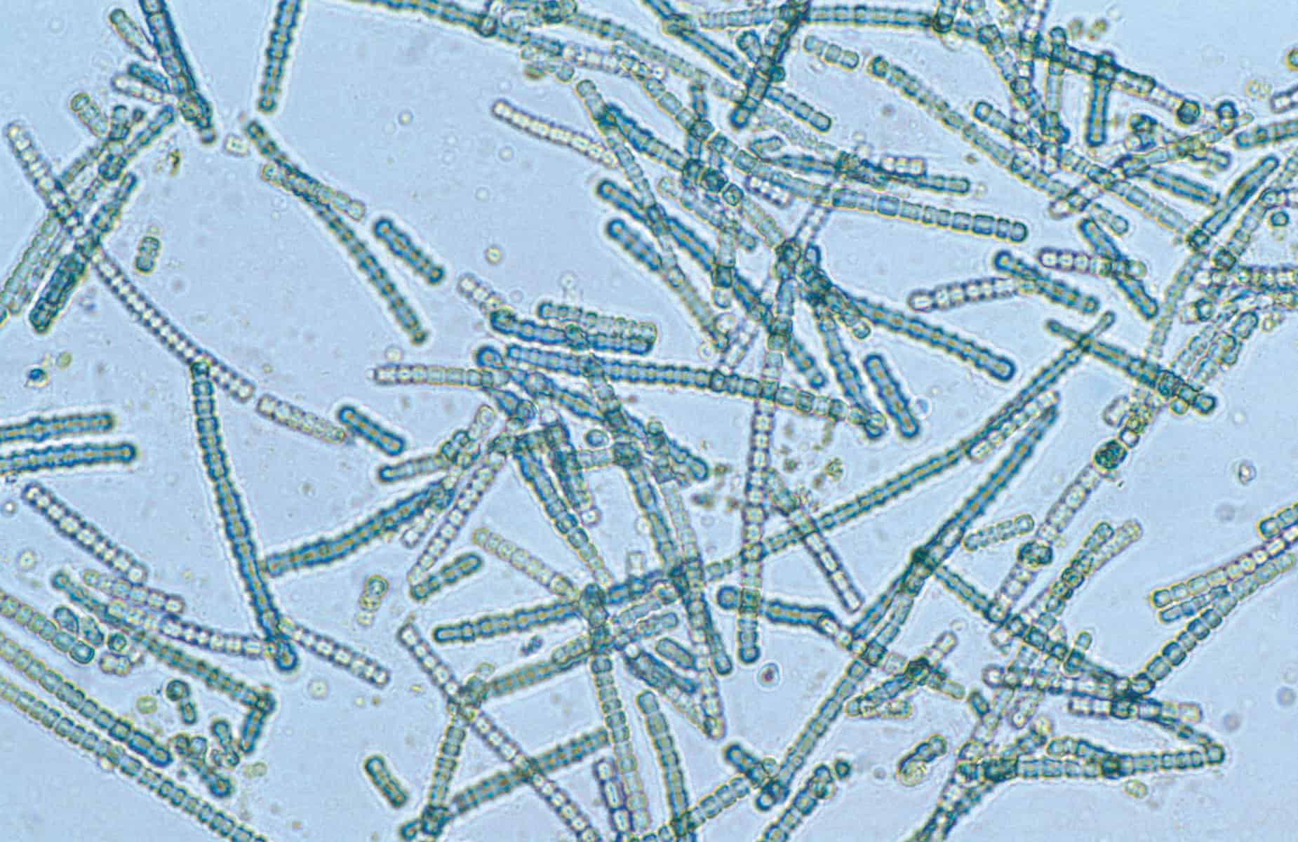Cyanobacteria under the microscope