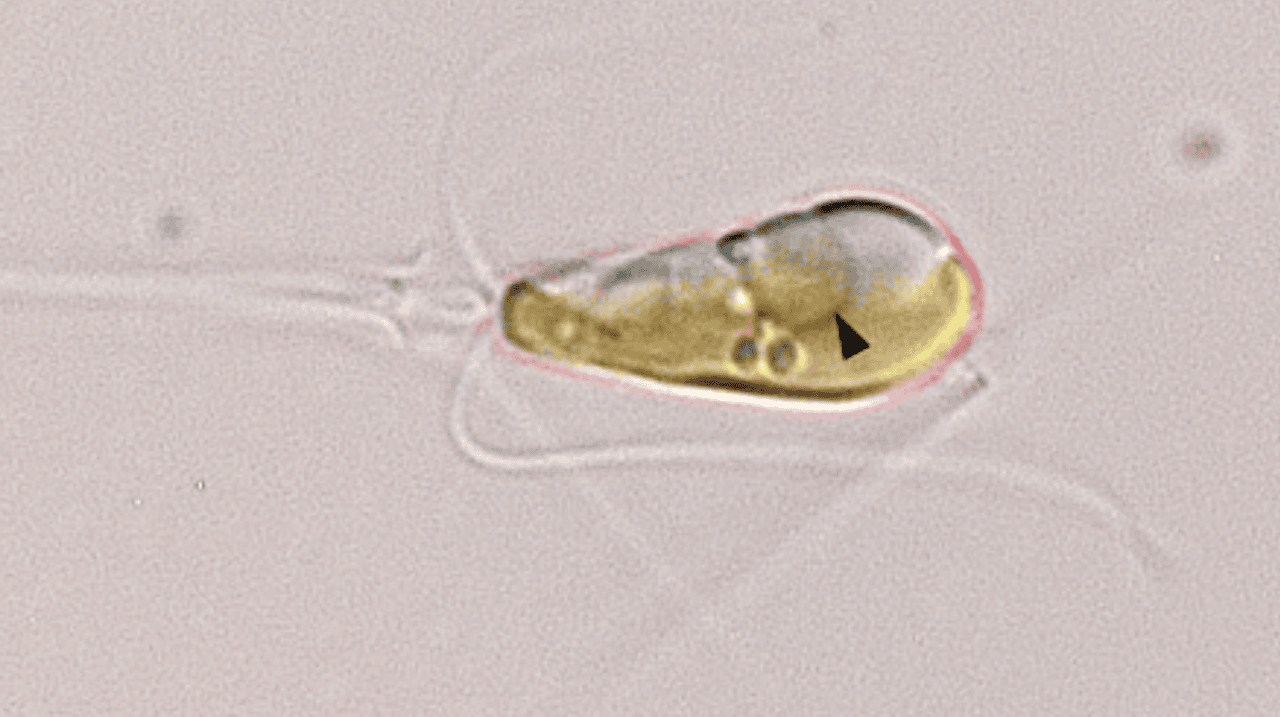 Una imagen de microscopía óptica muestra el alga haptofita marina Braarudosphaera bigelowii con una flecha negra que apunta al orgánulo nitroplasto.  (Crédito de la foto: Tyler Coale)